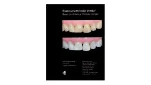 libro blanqueamiento dental